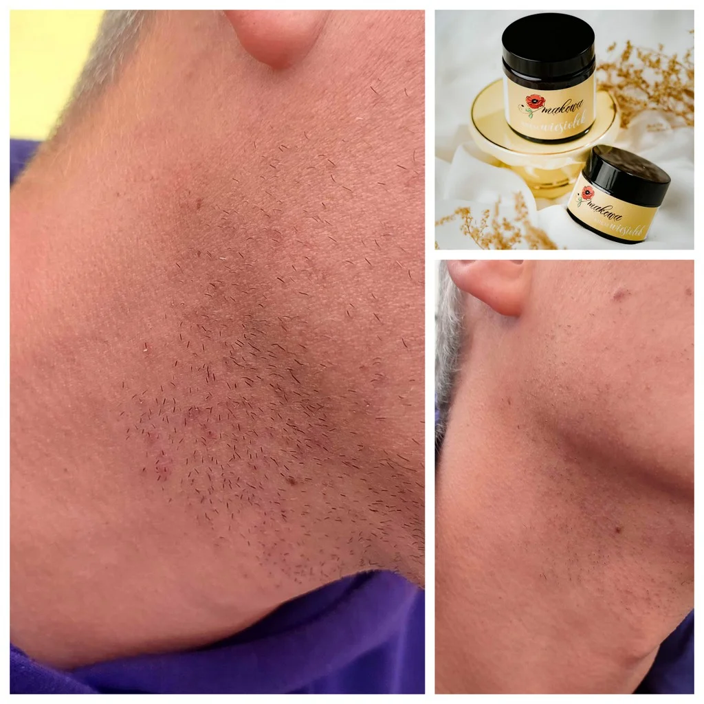 KREM DO TWARZY, CIAŁA I RĄK WIESIOŁEK