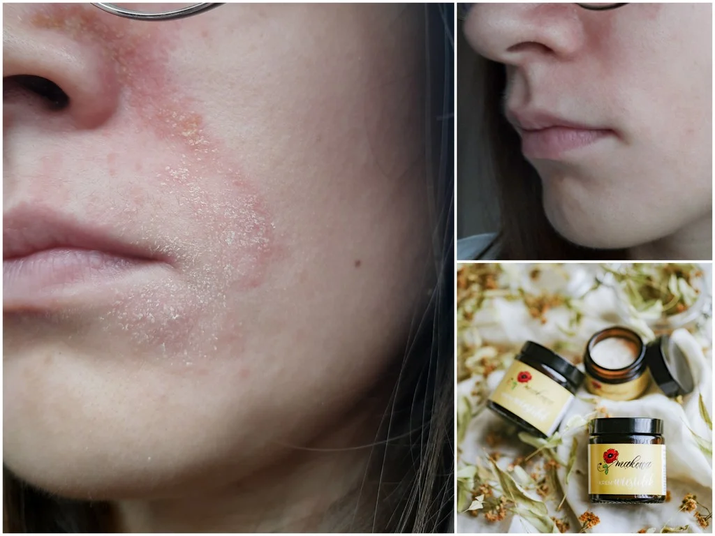 KREM DO TWARZY, CIAŁA I RĄK WIESIOŁEK